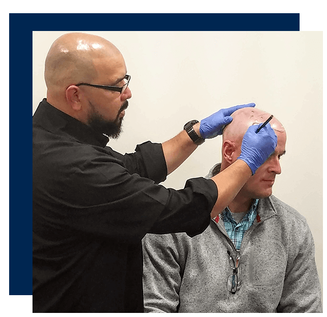 Scalp Micropigmentation - Looking For Hairline Tattoo Services?