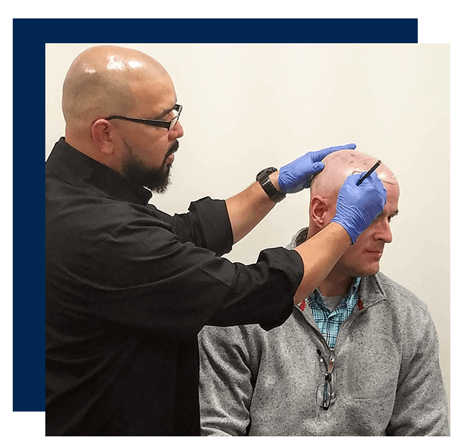 Scalp micropigmentation SMP Benefits costs results